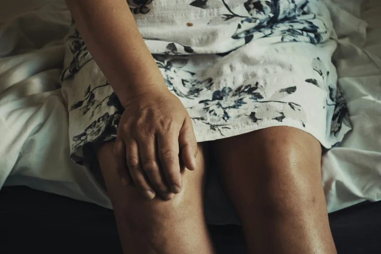 Mengenal Apa Itu Osteoarthritis dan Penyebabnya